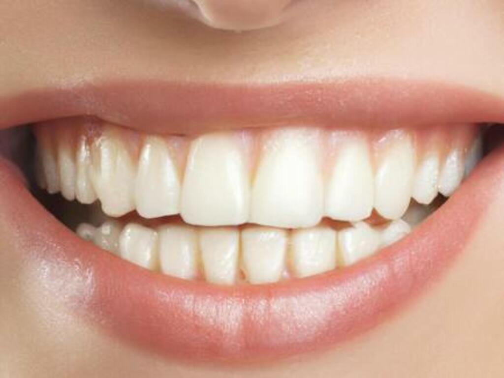 What is Gummy Smile Treatment?