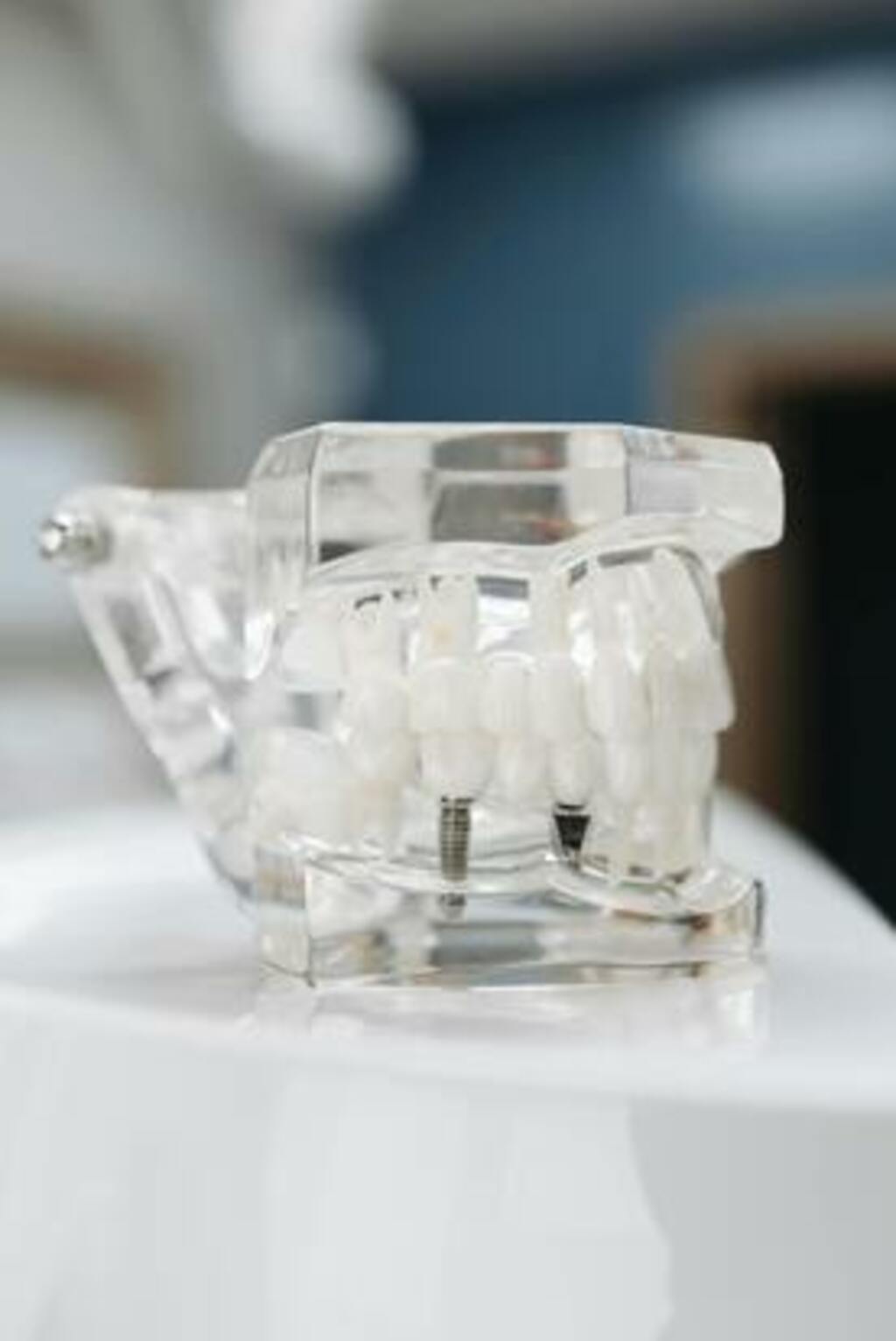 How Do Dental Implants Work?
