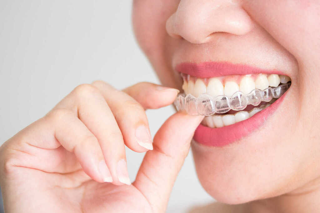 Orthodontics at Shree Krishna Dental Care Bhubaneswar